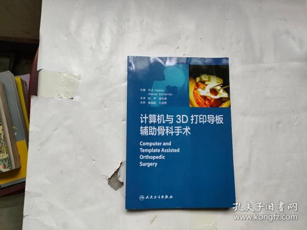 计算机与3D打印导板辅助骨科手术