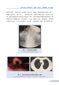 北京医学会风湿病学分会病例串串烧优秀集锦