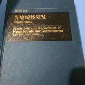 肝癌转移复发的基础与临床