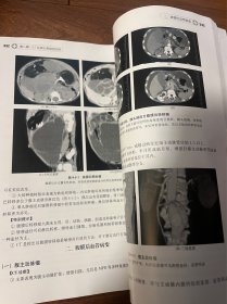 影像读片从入门到精通系列：CT读片指南（第2版）