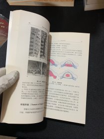 Duus神经系统疾病定位诊断学