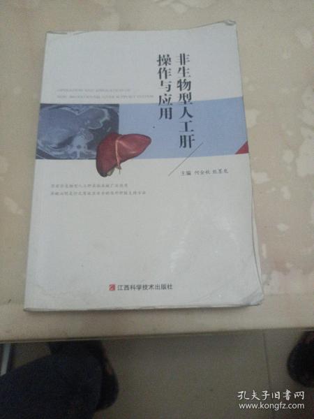 非生物型人工肝操作与应用