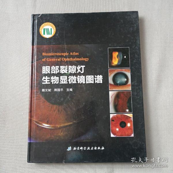 眼部裂隙灯生物显微镜图谱