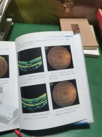 协和眼科光学相干断层扫描（OCT）图谱