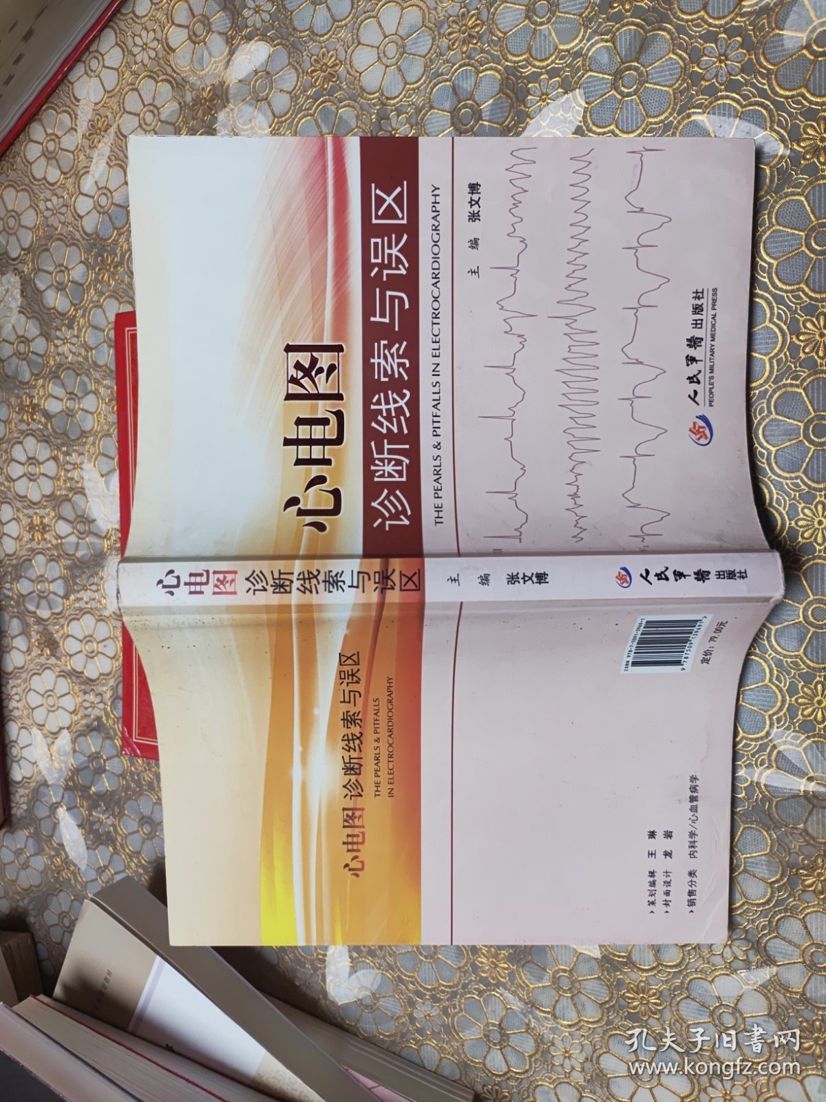 心电图诊断线索与误区