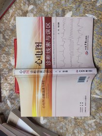 心电图诊断线索与误区