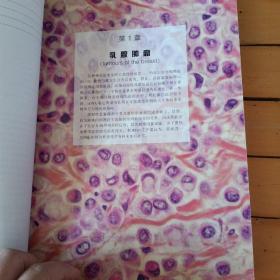 乳腺及女性生殖器官肿瘤病理学和遗传学 -内页有铅笔笔迹