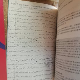 脑电图判读（原书第4版）（全2册）