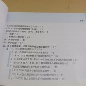 中国临床肿瘤学会(CSCO)原发性肺癌诊疗指南2019