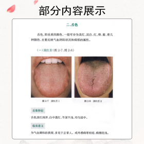 中医舌诊图谱