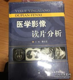 医学影像读片分析