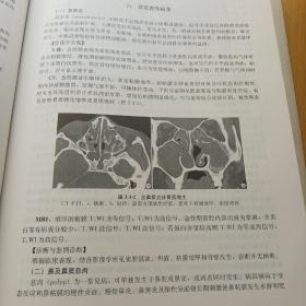 医学影像诊断学