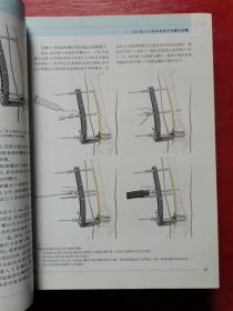 内固定支架：理念及LCP、LISS的临床应用