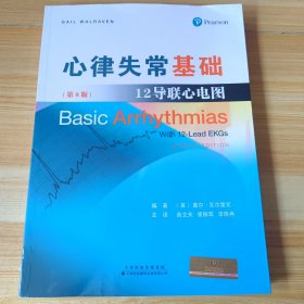 心律失常基础:12导联心电图