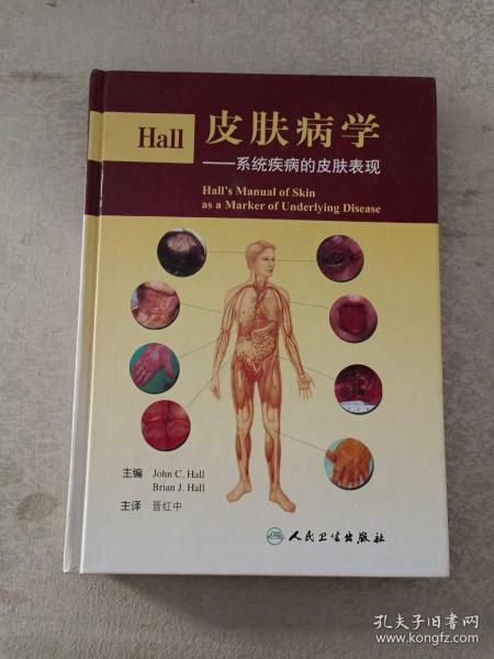 Hall皮肤病学：系统疾病的皮肤表现