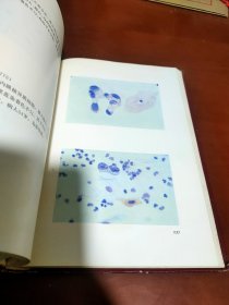阴道细胞学图谱