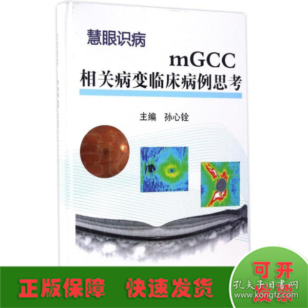 mGCC相关病变临床病例思考