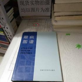 眼病图谱一版一印