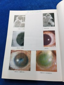 中西医结合眼科学