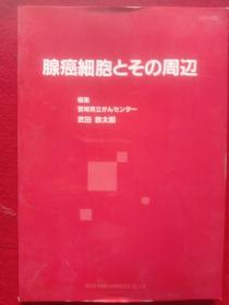 腺癌细胞とその周辺。(日语，本册是大开本)