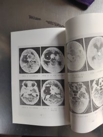 头颈部cT临床实用图谱（无笔记丶品相好丶实物拍摄）