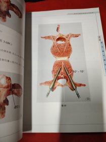 脊柱内固定系统应用指南