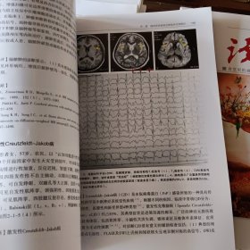 脑血管病诊断与鉴别诊断：临床实例图示