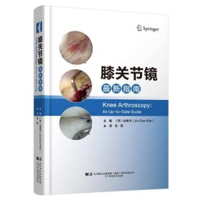 膝關(guān)節(jié)鏡指南