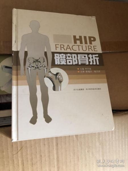 髋部骨折
