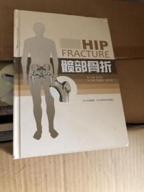 髋部骨折