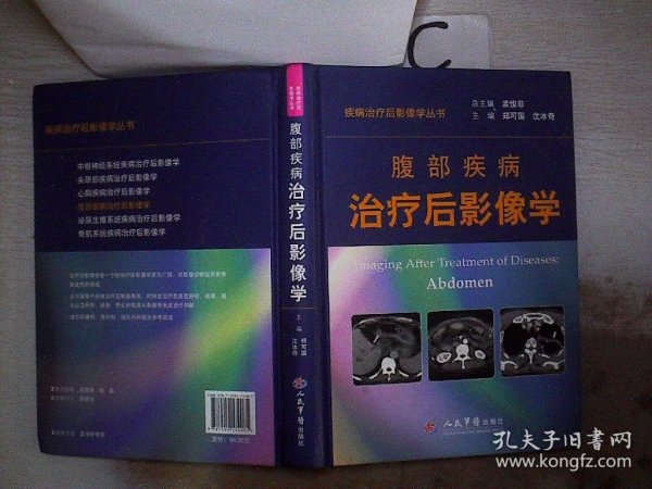 疾病治疗后影像学丛书：腹部疾病治疗后影像学 郑可国//沈冰奇|主编:孟悛非 9787509174081 人民军医