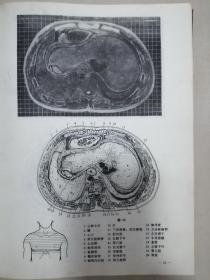 人体断面解剖学图谱