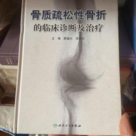 骨质疏松性骨折的临床诊断及治疗