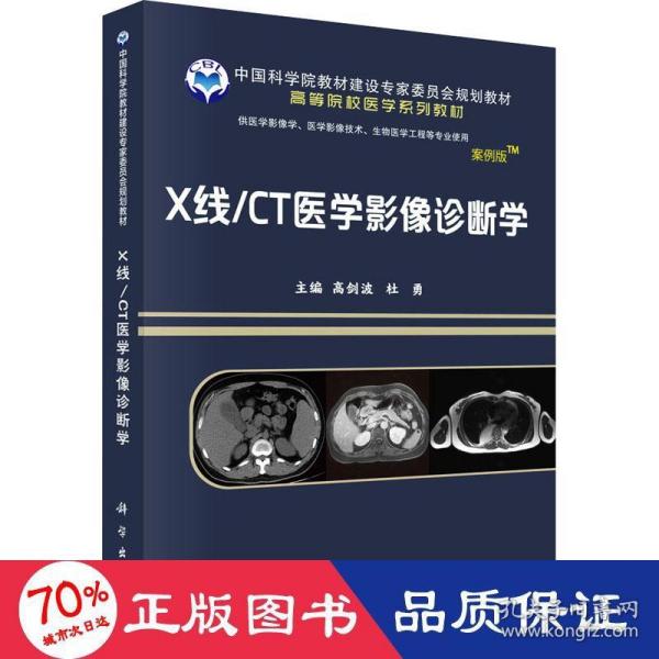 X线/CT医学影像诊断学