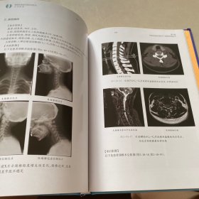 单侧双通道内镜实用技术手术图谱(签名本)