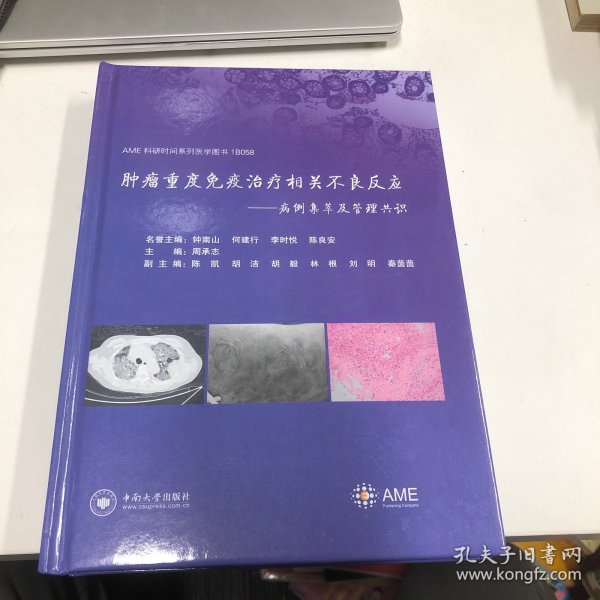 肿瘤重度免疫治疗相关不良反应——病例集萃及管理共识