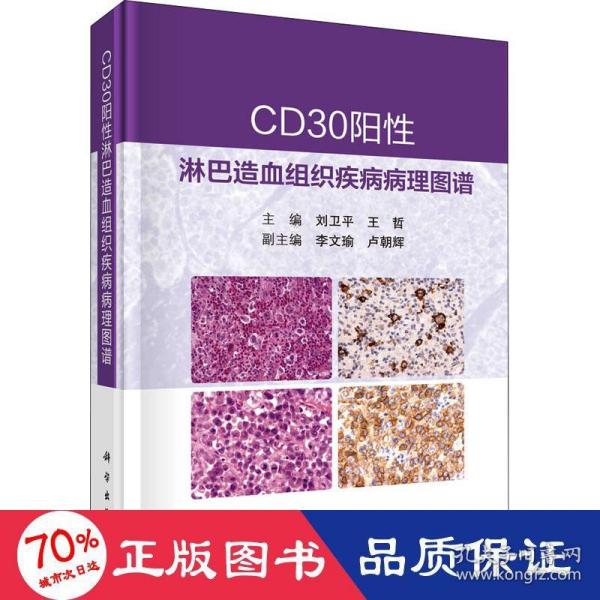 CD30阳性淋巴造血组织疾病病理图谱 刘卫平 王哲著