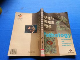 淋巴瘤與瘤樣增生病理學(xué)