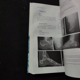 AO足踝骨折治疗原则
