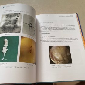 单侧双通道内镜实用技术手术图谱(签名本)