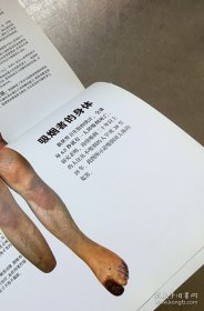 老医药：慢性病家庭防治指南（原北京市卫生局副局长梁万年主编）