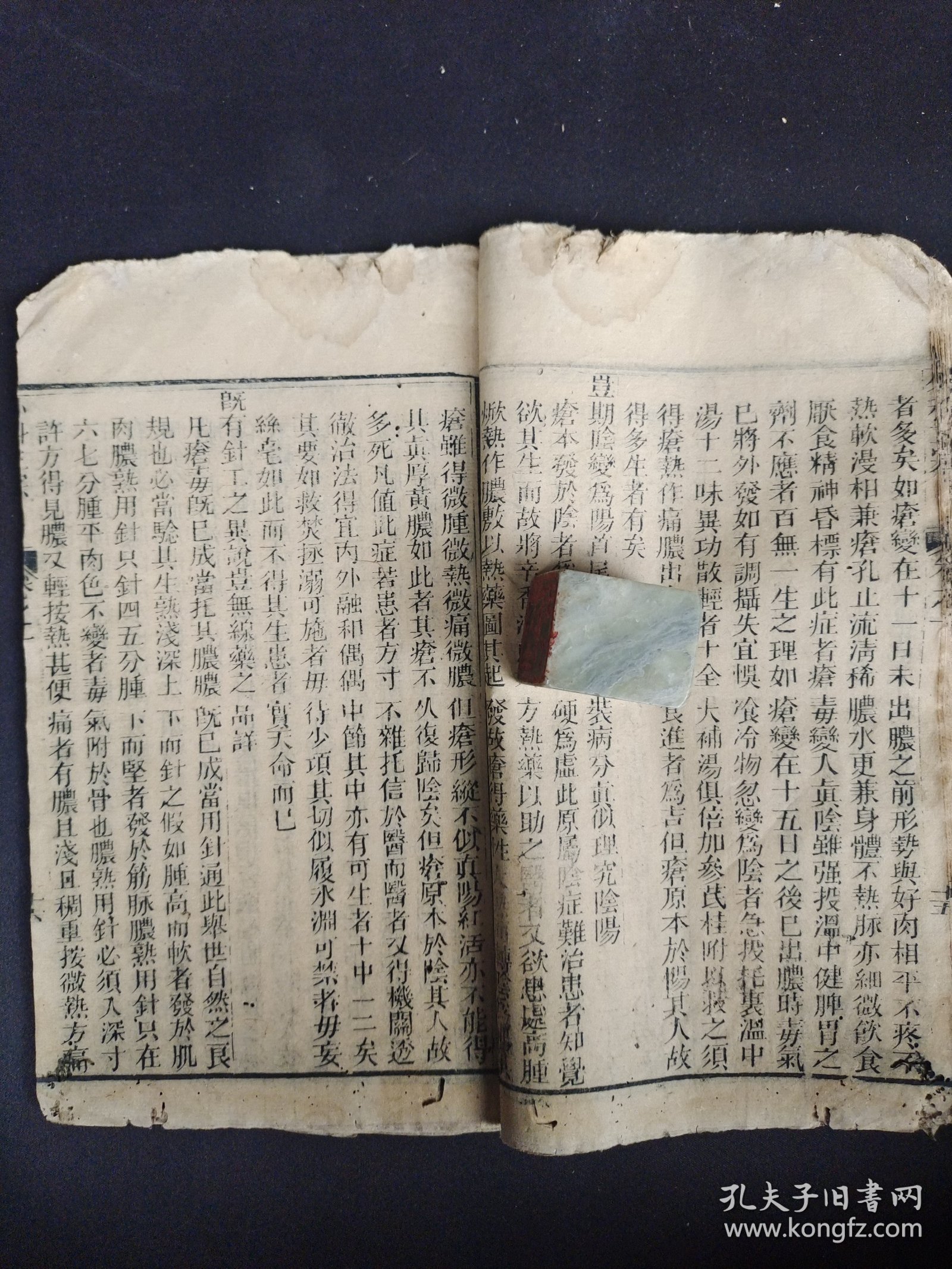 《外科正宗》卷一，清代木刻本。