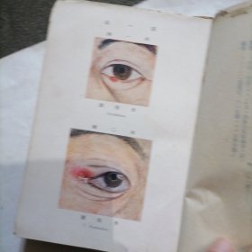 《外眼病图谱》民国日文版一册～包邮
