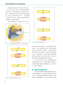 颞骨与侧颅底显微外科手术中面神经的处理