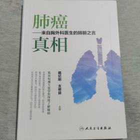 肺癌 真相——来自胸外科医生的肺腑之言