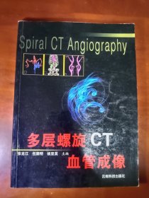 多層螺旋CT血管成像