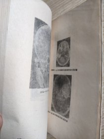 神经外科学基础与临床
