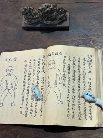 清代中医手写本《跌打损伤、穴位点打》，数十幅图