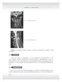 新华正版 积水潭放射读片——骨肿瘤之中轴骨篇 程晓光,苏永彬 9787567919082 中国协和医科大学出版社