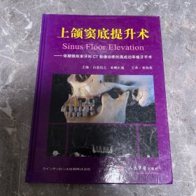 上颌窦底提升术